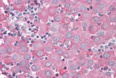 Immunohistochemistry: PTP alpha/PTPRA Antibody [NBP3-14454]